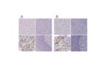 Immunohistochemical staining of human liver, pancreas, pituitary gland and tonsil using Anti-POU1F1 antibody HPA050624 (A) shows similar protein distribution across tissues to independent antibody HPA041646 (B).