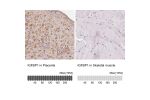 Immunohistochemistry analysis in human placenta and skeletal muscle tissues using HPA050640 antibody. Corresponding IGFBP1 RNA-seq data are presented for the same tissues.