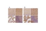 Immunohistochemical staining of human cerebellum, cerebral cortex, testis and tonsil using Anti-FSCN1 antibody HPA050654 (A) shows similar protein distribution across tissues to independent antibody HPA005723 (B).