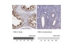 Immunohistochemistry analysis in human testis and endometrium tissues using Anti-PBK antibody. Corresponding PBK RNA-seq data are presented for the same tissues.