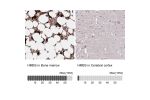 Immunohistochemistry analysis in human bone marrow and cerebral cortex tissues using Anti-HMBS antibody. Corresponding HMBS RNA-seq data are presented for the same tissues.