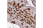 Immunohistochemical staining of human placenta shows strong nuclear and cytoplasmic positivity in decidual cells.