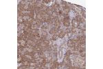 Immunohistochemical staining of human pancreas shows moderate cytoplasmic and nuclear positivity in exocrine glandular cells.