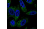 Immunofluorescent staining of human cell line PC-3 shows localization to cytosol.