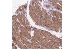 Immunohistochemical staining of human stomach, lower shows moderate cytoplasmic positivity in glandular cells.