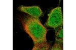 Immunofluorescent staining of human cell line A-431 shows localization to nucleoplasm & plasma membrane.