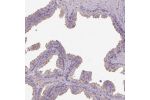 Immunohistochemical staining of human prostate shows weak to moderate cytoplasmic positivity in glandular cells.