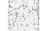 Immunohistochemical staining of human soft tissue shows strong positivity in adipocytes.