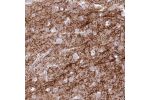 Immunohistochemical staining of human cerebral cortex shows strong positivity in neuronal processes.