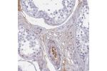 Immunohistochemical staining of human testis shows weak cytoplasmic positivity in Leydig cells, as well as moderate positivity in plasma.