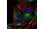 Immunofluorescent staining of human cell line SK-MEL-30 shows localization to vesicles.