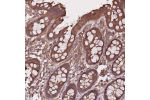 Immunohistochemical staining of human stomach, upper shows strong cytoplasmic and membranous positivity in glandular cells.
