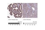 Immunohistochemistry analysis in human fallopian tube and pancreas tissues using HPA050918 antibody. Corresponding CLTA RNA-seq data are presented for the same tissues.