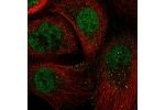 Immunofluorescent staining of human cell line A-431 shows localization to nucleoplasm & vesicles.
