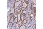 Immunohistochemical staining of human thyroid gland shows strong cytoplasmic positivity in glandular cells.