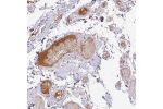 Immunohistochemical staining of human small intestine shows positivity in plasma.
