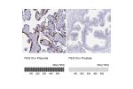 Immunohistochemistry analysis in human placenta and prostate tissues using Anti-PEG10 antibody. Corresponding PEG10 RNA-seq data are presented for the same tissues.