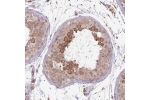Immunohistochemical staining of human testis shows strong cytoplasmic positivity in cells of seminiferus ducts.