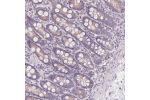 Immunohistochemical staining of human duodenum shows moderate cytoplasmic positivity in glandular cells.