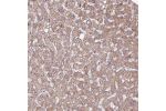 Immunohistochemical staining of human kidney shows strong cytoplasmic positivity in cells in tubules.
