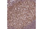 Immunohistochemical staining of human tonsil shows strong nuclear positivity in germinal center cells.