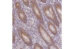 Immunohistochemical staining of human stomach, lower shows moderate cytoplasmic positivity in glandular cells.