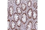 Immunohistochemical staining of human rectum shows moderate nuclear positivity in glandular cells.
