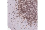 Immunohistochemical staining of human cerebellum shows strong nuclear positivity in cells in molecular layer.
