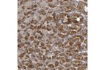 Immunohistochemical staining of human stomach, lower shows strong cytoplasmic positivity in glandular cells.