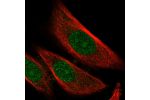 Immunofluorescent staining of human cell line PC-3 shows localization to nucleus, nucleoli & cytosol.