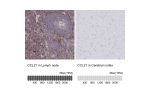 Immunohistochemistry analysis in human lymph node and cerebral cortex tissues using HPA051210 antibody. Corresponding CCL21 RNA-seq data are presented for the same tissues.