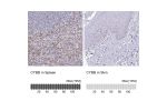 Immunohistochemistry analysis in human spleen and skin tissues using HPA051227 antibody. Corresponding CYBB RNA-seq data are presented for the same tissues.