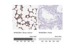 Immunohistochemical staining of human bone marrow shows strong cytoplasmic and nuclear positivity in hematopoietic cells.