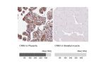 Immunohistochemical staining of human kidney shows weak to moderate membranous and cytoplasmic positivity in cells in tubules.