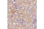 Immunohistochemical staining of human kidney shows moderate cytoplasmic and luminal membranous positivity in cells in tubules.