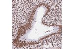 Immunohistochemical staining of human endometrium shows strong nuclear positivity in glandular cells.