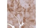 Immunohistochemical staining of human skeletal muscle shows moderate cytoplasmic positivity in myocytes.