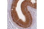 Immunohistochemical staining of human epididymis shows strong cytoplasmic positivity in glandular cells.