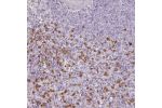 Immunohistochemical staining of human spleen shows strong cytoplasmic positivity in cells in red pulp.