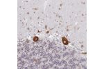 Immunohistochemical staining of human cerebellum shows strong cytoplasmic positivity in Purkinje cells.