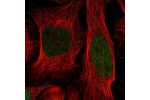 Immunofluorescent staining of human cell line U-2 OS shows localization to nucleoplasm.