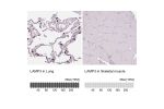 Immunohistochemistry analysis in human lung and skeletal muscle tissues using HPA051467 antibody. Corresponding LAMP3 RNA-seq data are presented for the same tissues.