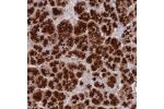 Immunohistochemical staining of human pancreas shows strong cytoplasmic positivity in exocrine glandular cells.
