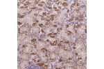 Immunohistochemical staining of human stomach shows moderate cytoplasmic positivity in parietal cells.