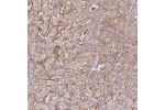 Immunohistochemical staining of human liver shows moderate granular cytoplasmic positivity in hepatocytes.