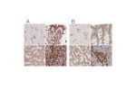 Immunohistochemical staining of human cerebral cortex, colon, liver and tonsil using Anti-RPN1 antibody HPA051520 (A) shows similar protein distribution across tissues to independent antibody HPA026828 (B).
