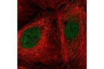 Immunofluorescent staining of human cell line A-431 shows localization to nucleoplasm.