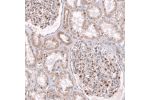 Immunohistochemical staining of human kidney shows moderate cytoplasmic positivity in a subset of cells in glomeruli.