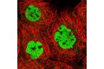 Immunofluorescent staining of human cell line A-431 shows localization to nucleoplasm.