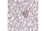 Immunohistochemical staining of human kidney shows moderate nuclear positivity in cells in tubules.